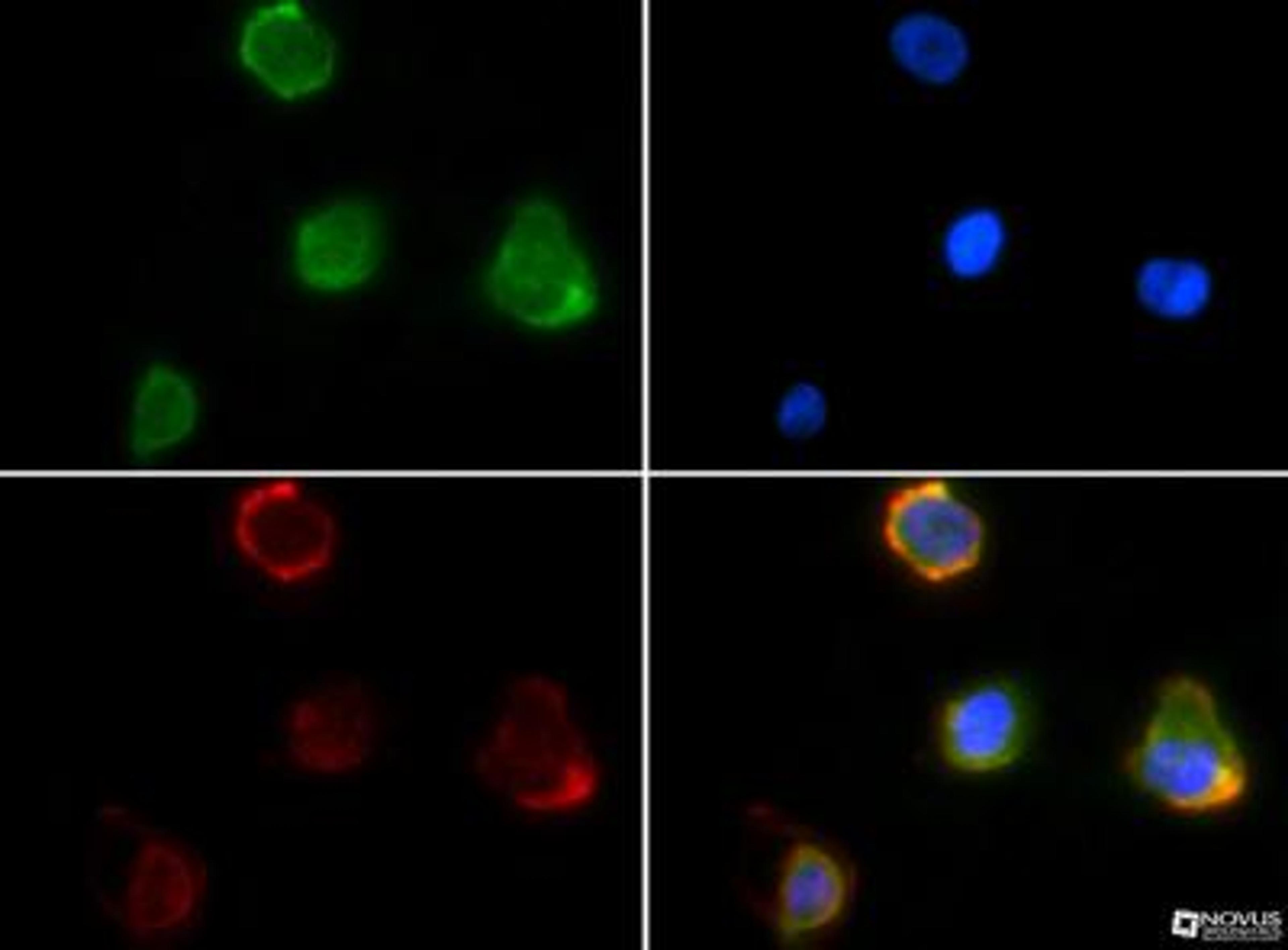 Immunocytochemistry/Immunofluorescence: S100A9 Antibody [NB110-89726] - S100A9 antibody was tested in A431 cells with FITC (green). Nuclei and alpha-tubulin were counterstained with Dapi (blue) and Dylight 550 (red).