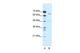 Antibody used in WB on Human HepG2 at 0.2-1 ug/ml.