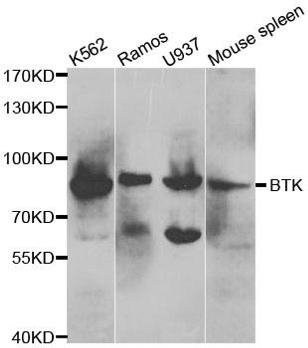 Western blot analysis of extracts of various cell lines using BTK antibody