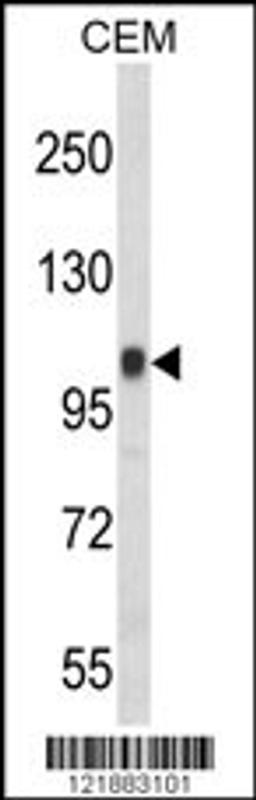 Western blot analysis of ITGB3 Antibody in CEM cell line lysates (35ug/lane)(2ug/ml)