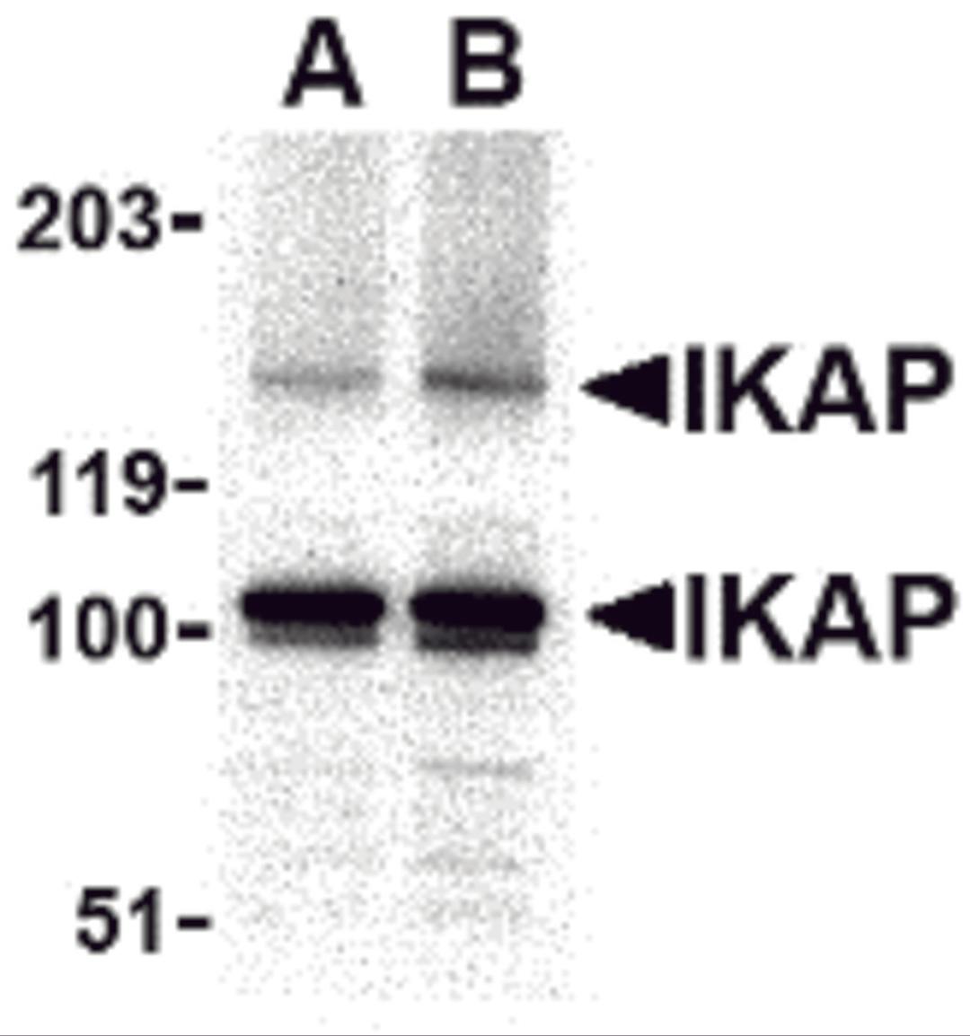 Western blot analysis of IKAP in A-20 cell lysate with IKAP antibody at in (A) 0.5, and (B) 1 μg/mL.