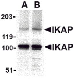 Western blot analysis of IKAP in A-20 cell lysate with IKAP antibody at in (A) 0.5, and (B) 1 μg/mL.
