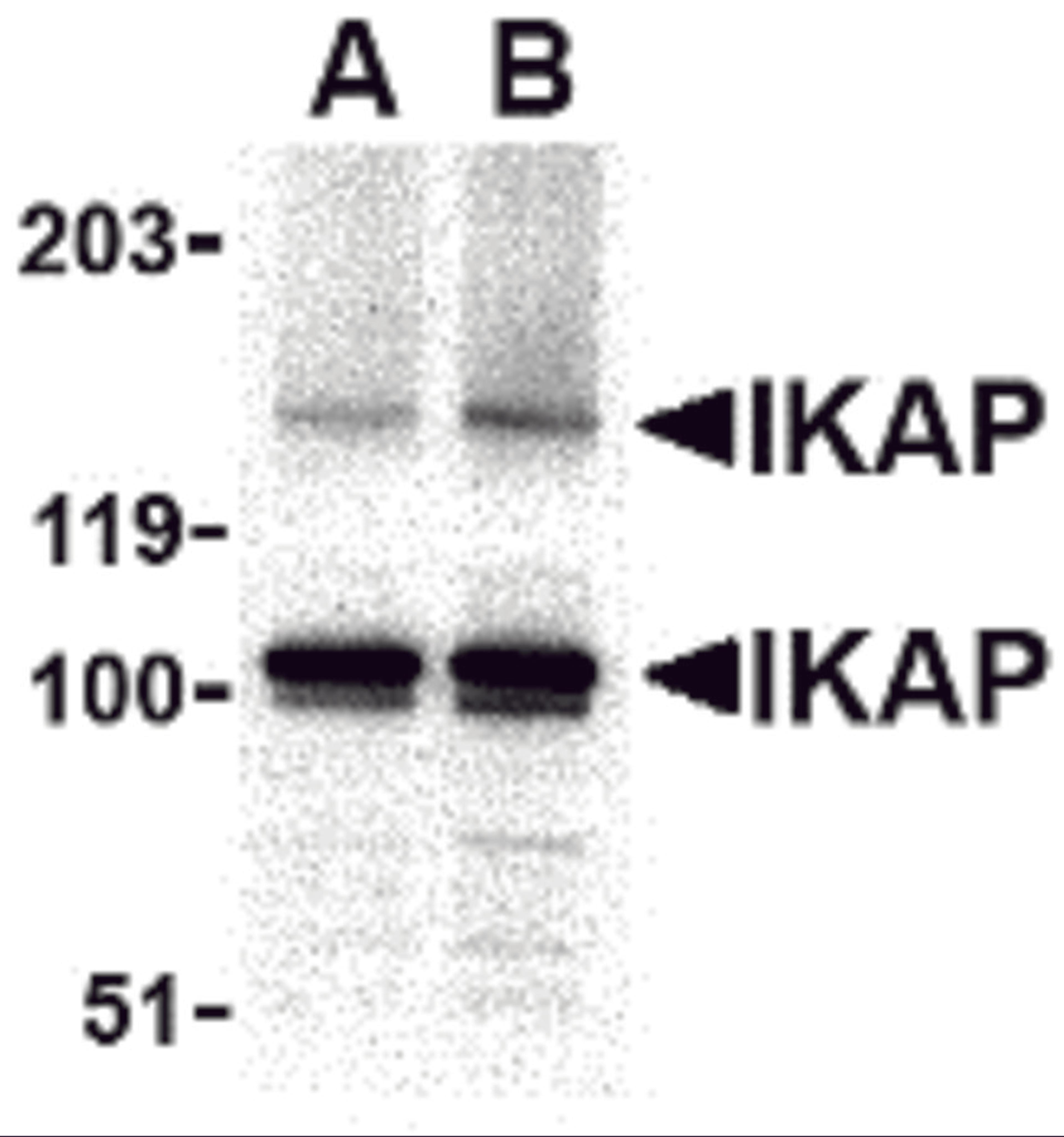 Western blot analysis of IKAP in A-20 cell lysate with IKAP antibody at in (A) 0.5, and (B) 1 μg/mL.