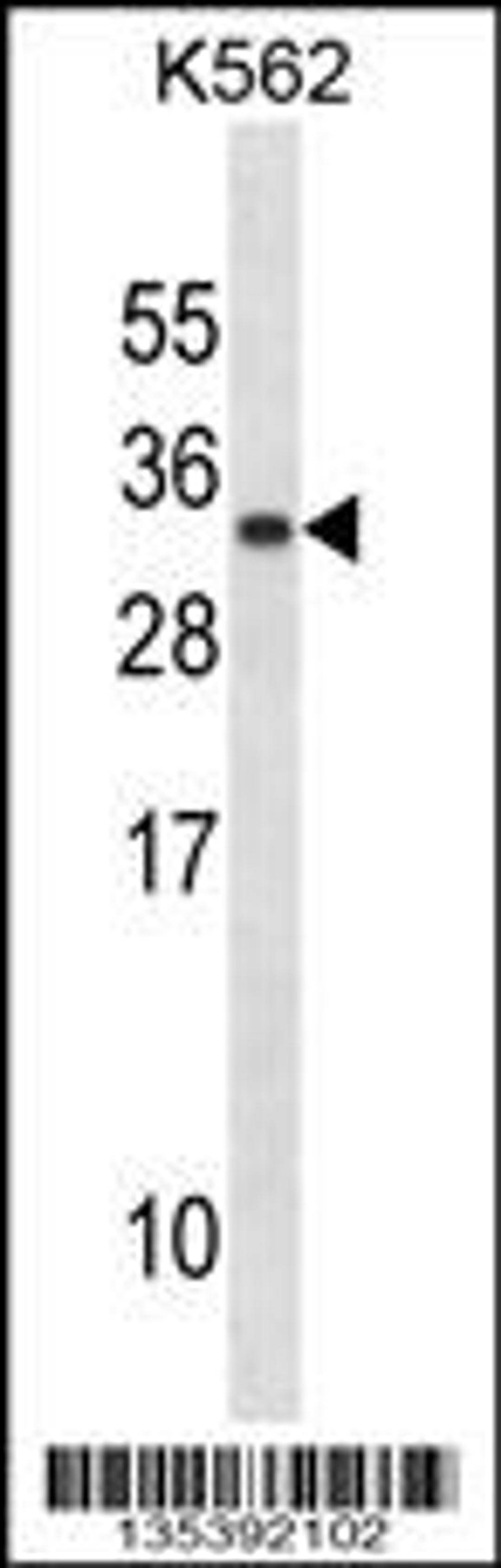 Western blot analysis in K562 cell line lysates (35ug/lane).