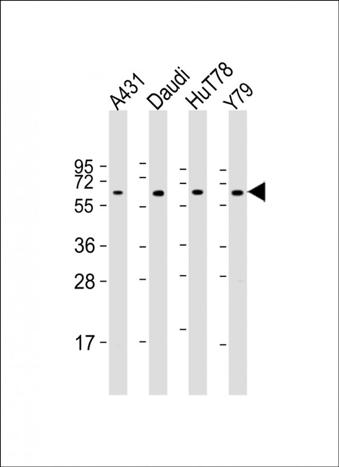 Western Blot at 1:2000 dilution Lane 1: A431 whole cell lysate Lane 2: Daudi whole cell lysate Lane 3: HuT78 whole cell lysate Lane 4: Y79 whole cell lysate Lysates/proteins at 20 ug per lane.