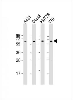 Western Blot at 1:2000 dilution Lane 1: A431 whole cell lysate Lane 2: Daudi whole cell lysate Lane 3: HuT78 whole cell lysate Lane 4: Y79 whole cell lysate Lysates/proteins at 20 ug per lane.