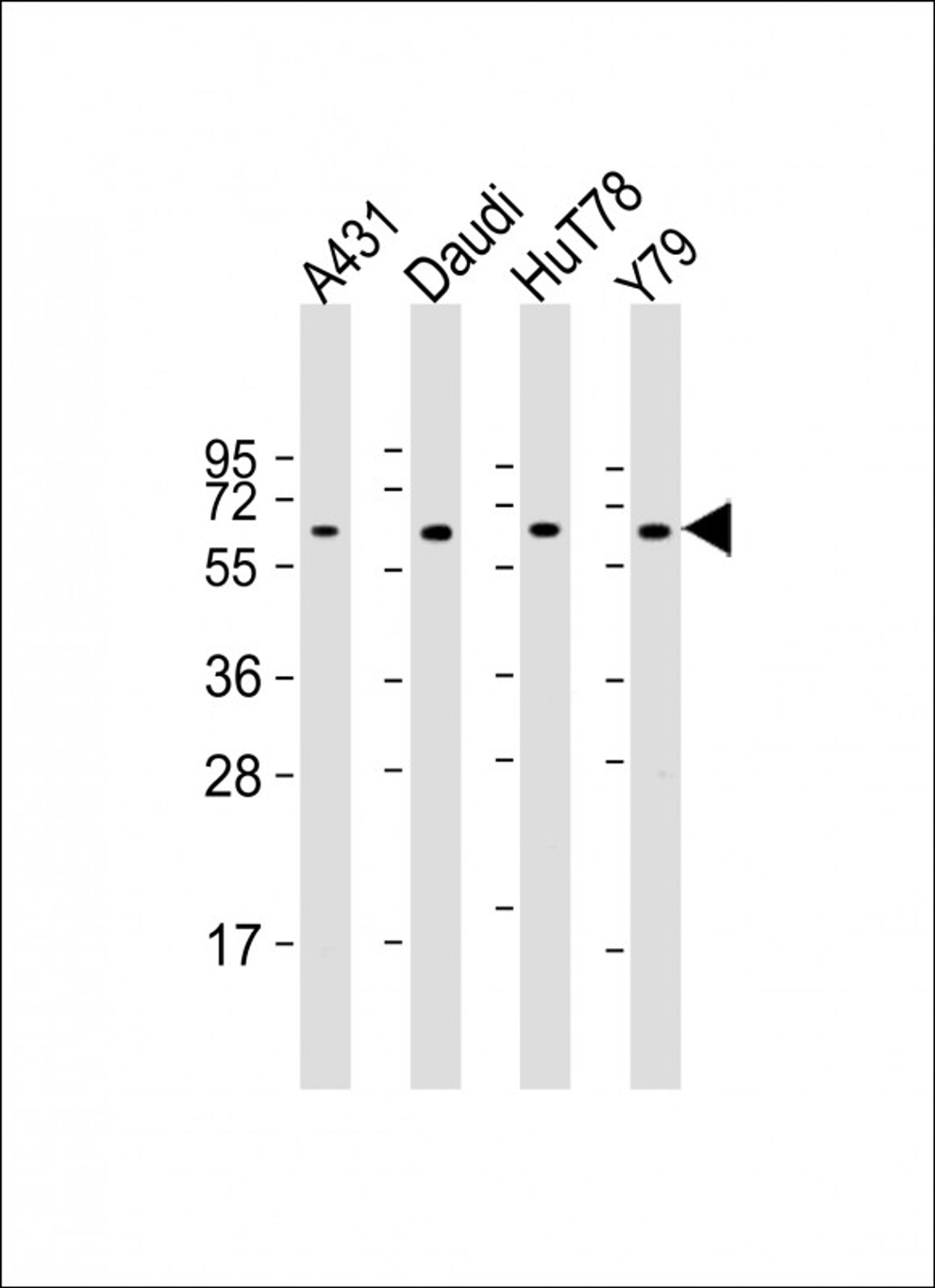 Western Blot at 1:2000 dilution Lane 1: A431 whole cell lysate Lane 2: Daudi whole cell lysate Lane 3: HuT78 whole cell lysate Lane 4: Y79 whole cell lysate Lysates/proteins at 20 ug per lane.