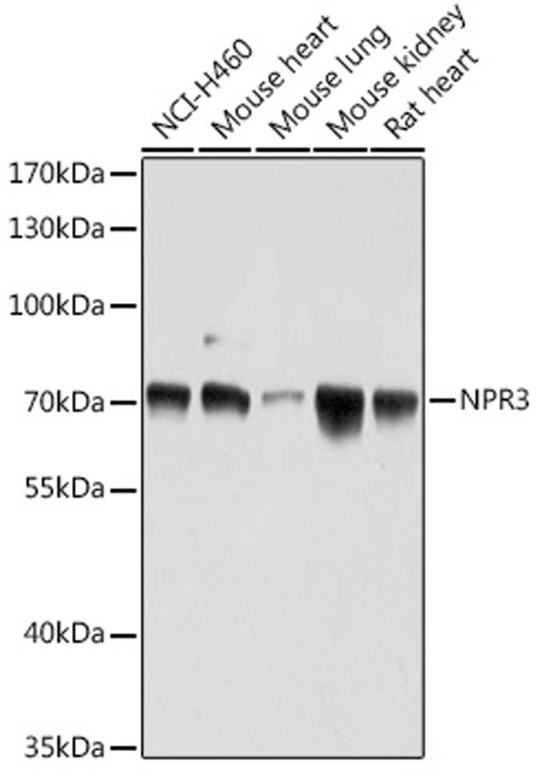 Western blot - NPR3 antibody (A16932)