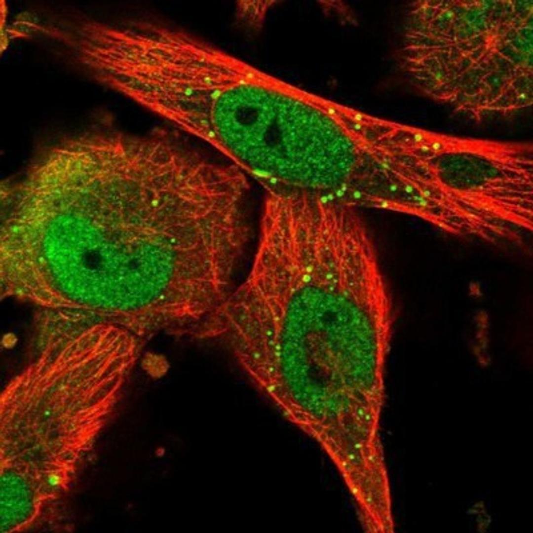 Immunocytochemistry/Immunofluorescence: GERP Antibody [NBP1-89776] - Staining of human cell line U-251MG shows positivity in nucleus but not nucleoli & vesicles.