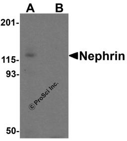 Western blot analysis of Nephrin in human kidney tissue lysate with Nephrin antibody at 1 &#956;g/ml in (A) the absence and (B) the presence of blocking peptide.