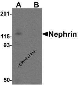 Western blot analysis of Nephrin in human kidney tissue lysate with Nephrin antibody at 1 μg/ml in (A) the absence and (B) the presence of blocking peptide.