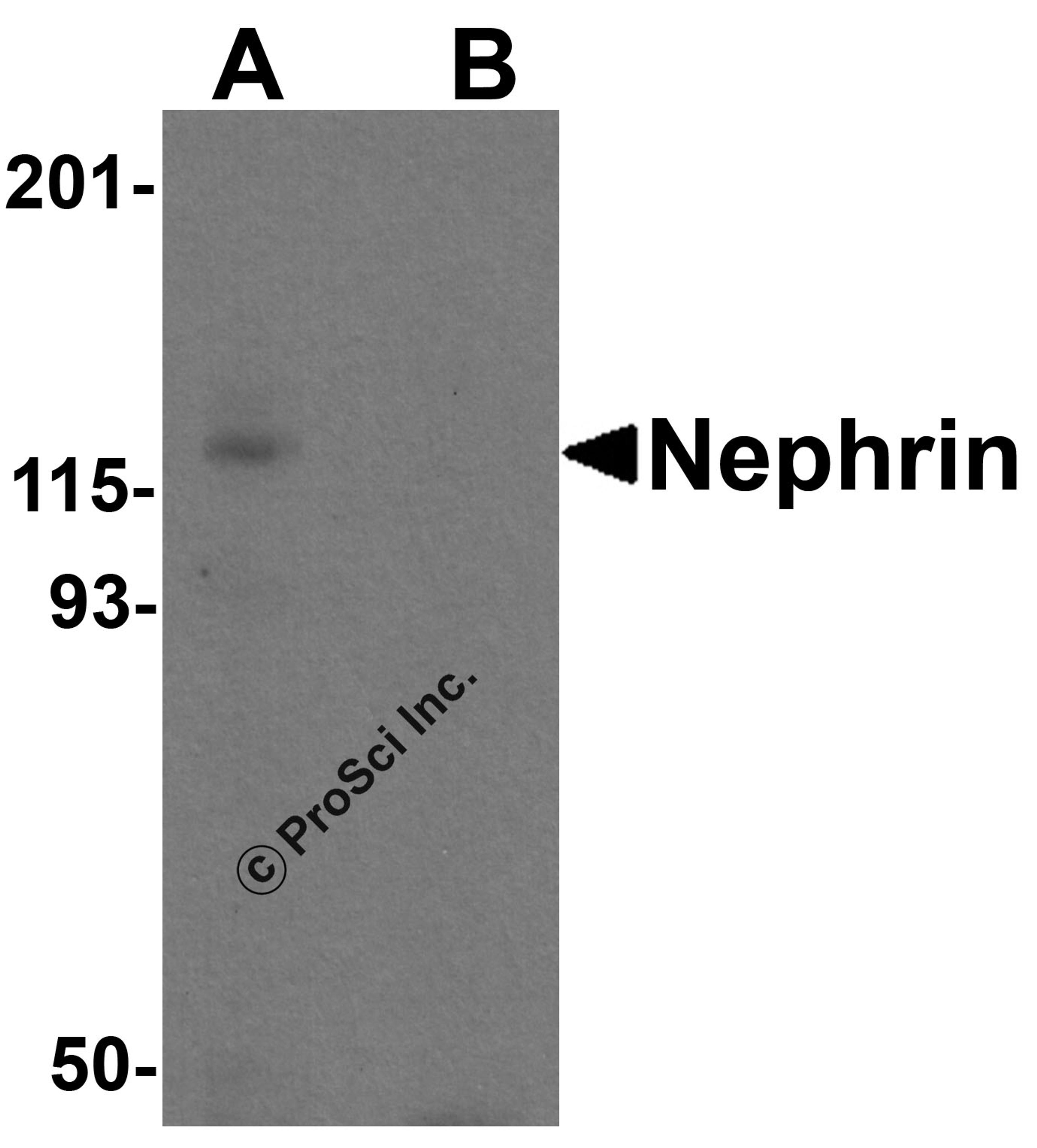 Western blot analysis of Nephrin in human kidney tissue lysate with Nephrin antibody at 1 μg/ml in (A) the absence and (B) the presence of blocking peptide.