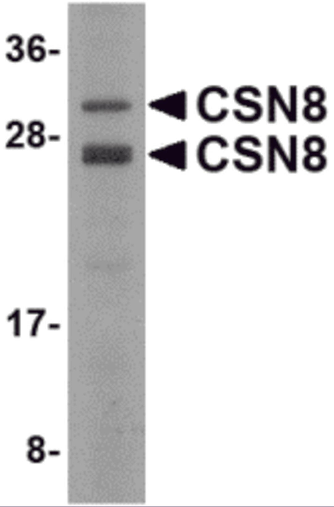 Western blot analysis of CSN8 in Human liver lysate with CSN8 antibody at 2 μg/mL.