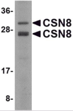 Western blot analysis of CSN8 in Human liver lysate with CSN8 antibody at 2 μg/mL.