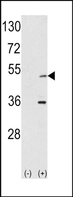 Western blot analysis of AIK using rabbit polyclonal hAIK-H105 using 293 cell lysates (2 ug/lane) either nontransfected (Lane 1) or transiently transfected with the AIK gene (Lane 2).