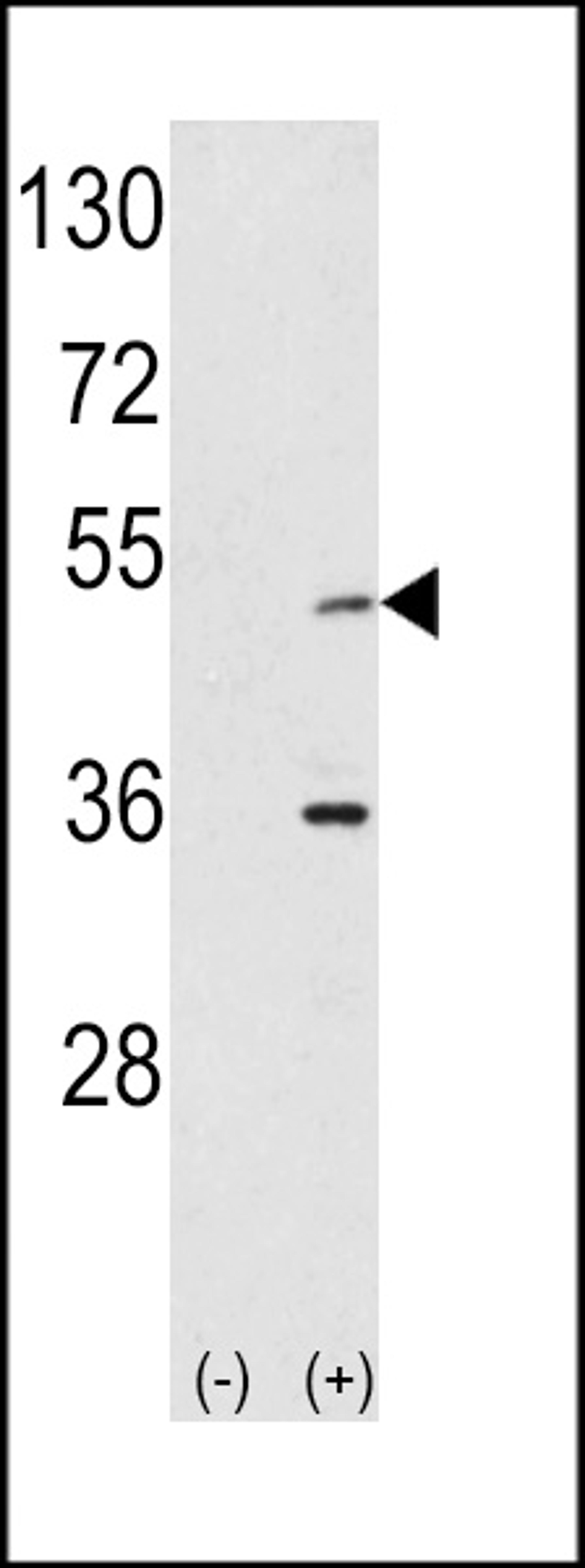 Western blot analysis of AIK using rabbit polyclonal hAIK-H105 using 293 cell lysates (2 ug/lane) either nontransfected (Lane 1) or transiently transfected with the AIK gene (Lane 2).