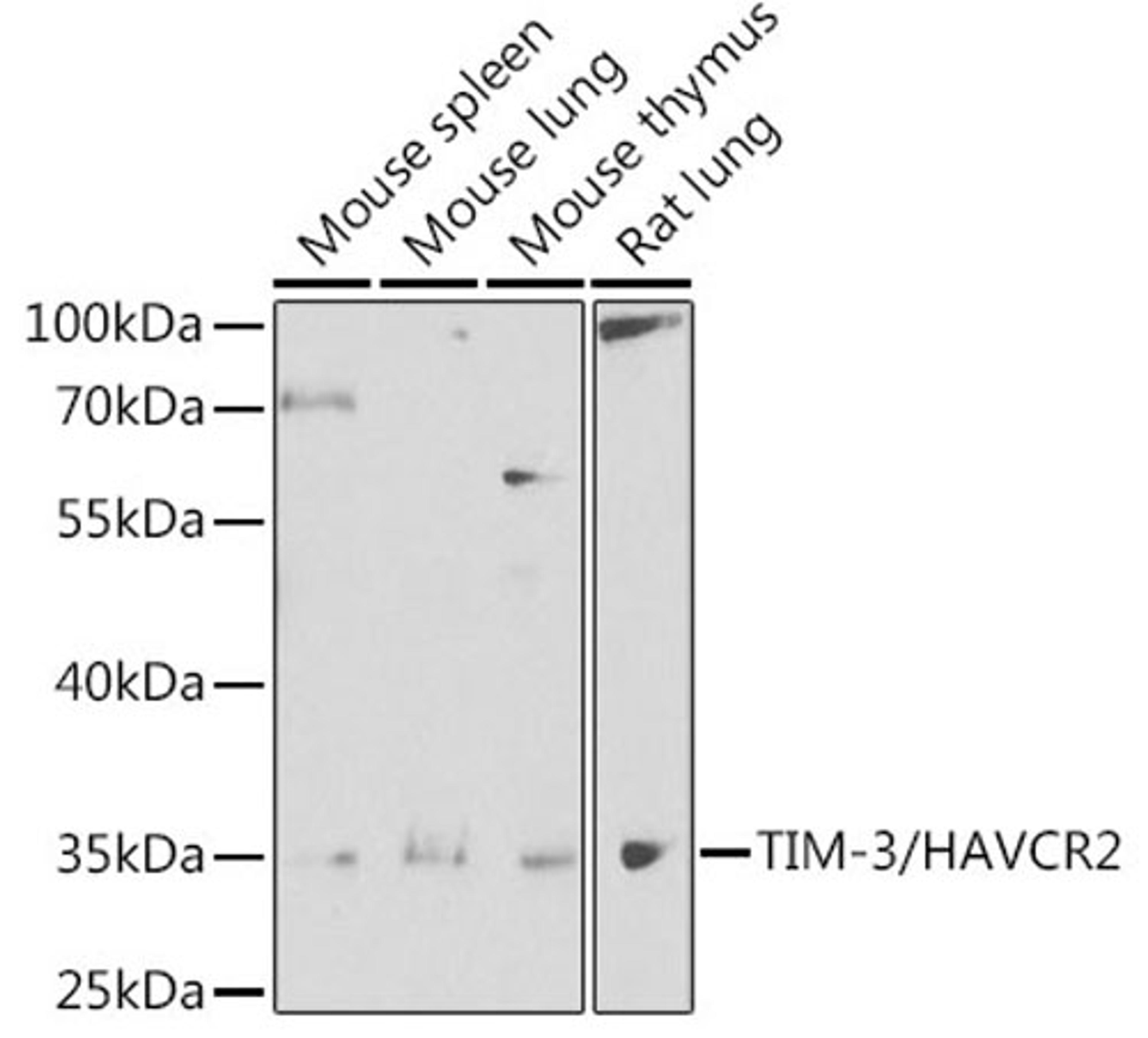 Western blot - TIM-3/HAVCR2 antibody (A13445)