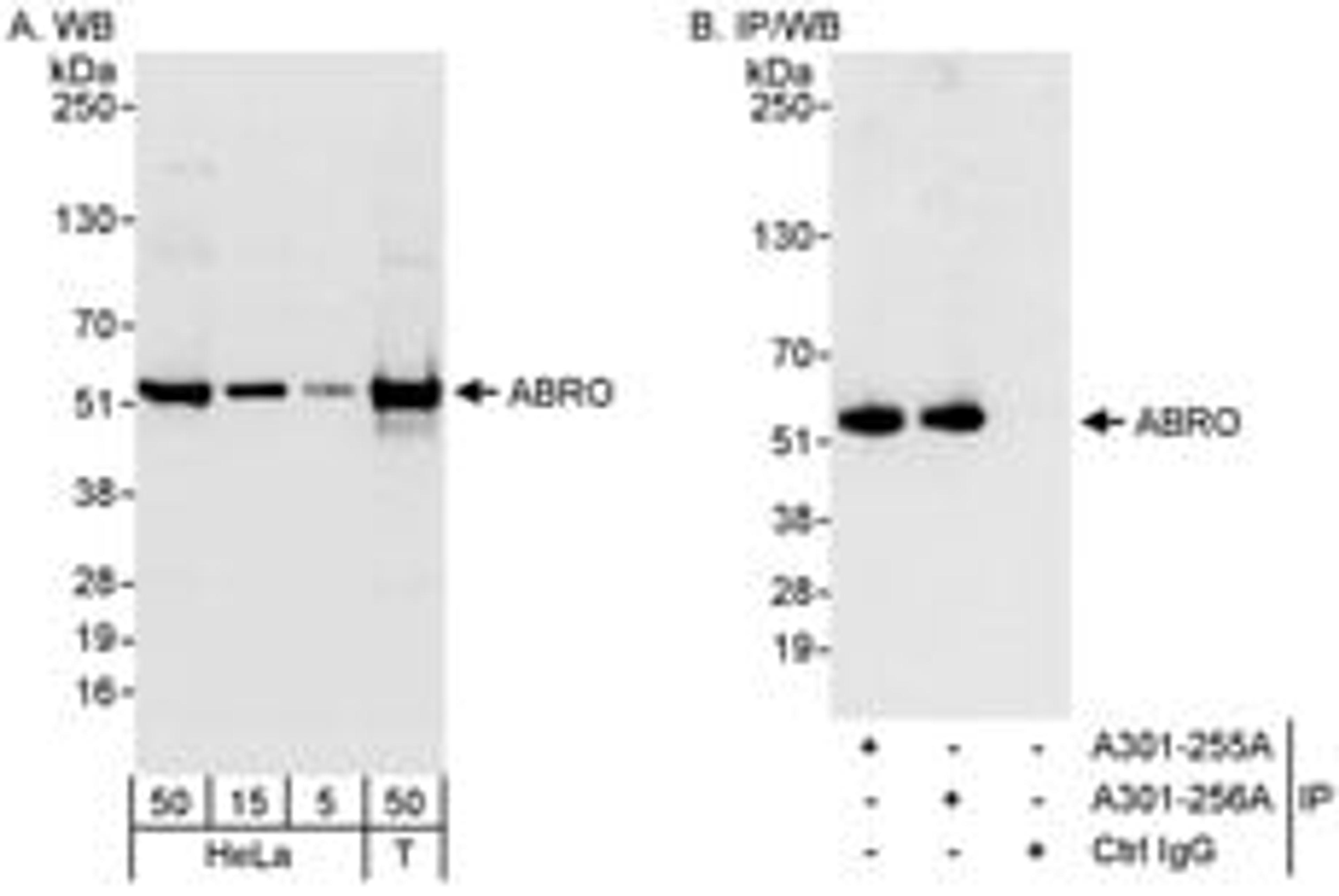 Detection of human ABRO by western blot and immunoprecipitation.