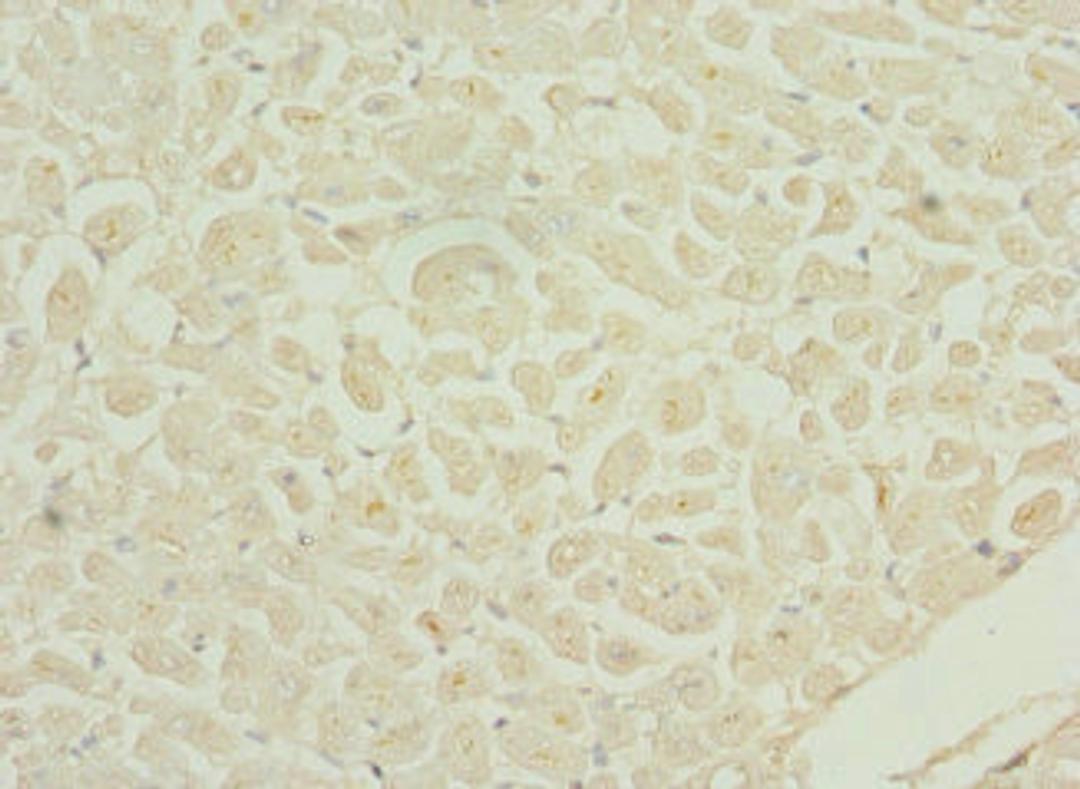 Immunohistochemistry of paraffin-embedded human heart tissue using CSB-PA866601ESR2HU at dilution of 1:100