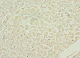 Immunohistochemistry of paraffin-embedded human heart tissue using CSB-PA866601ESR2HU at dilution of 1:100