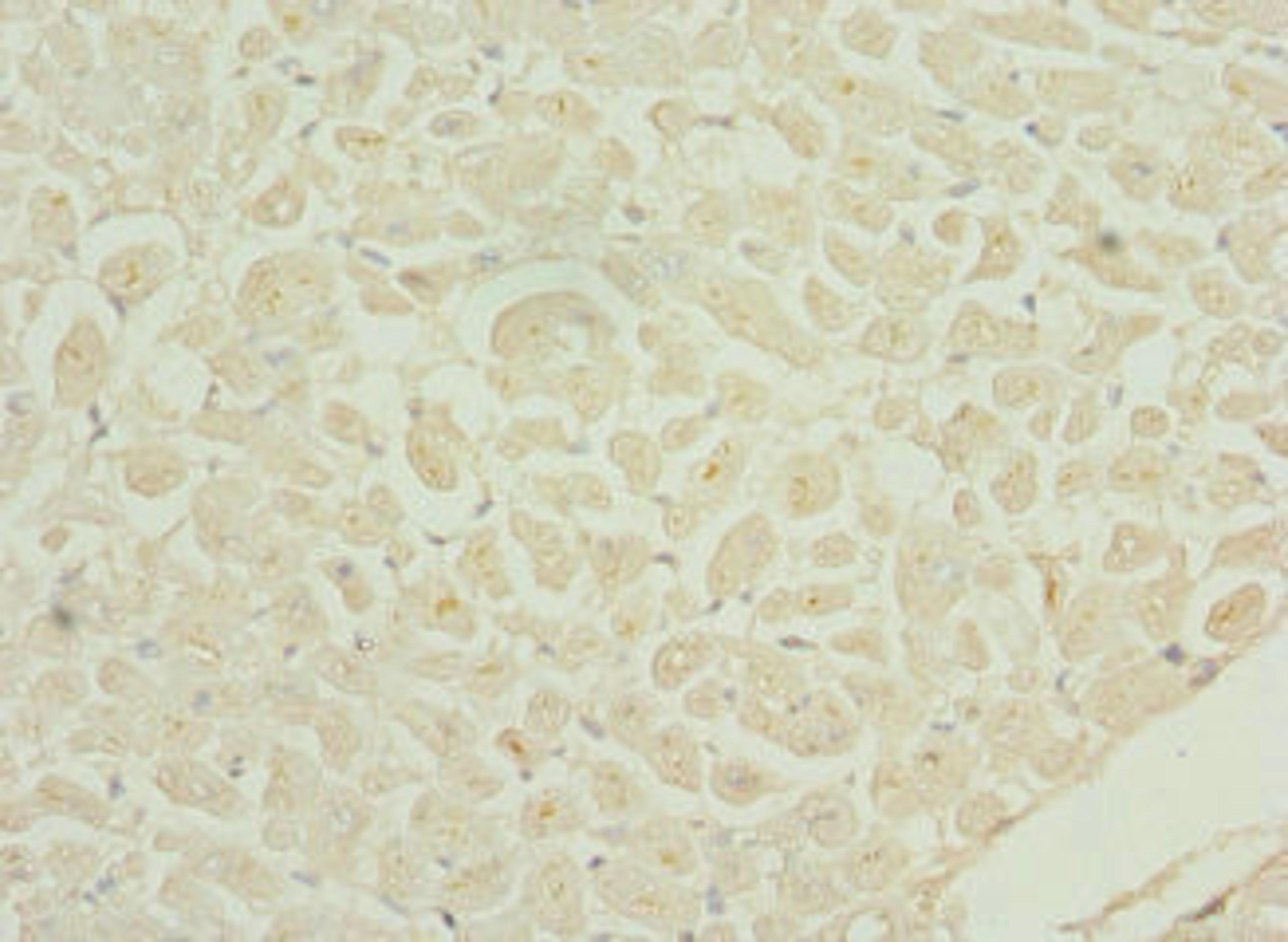 Immunohistochemistry of paraffin-embedded human heart tissue using CSB-PA866601ESR2HU at dilution of 1:100