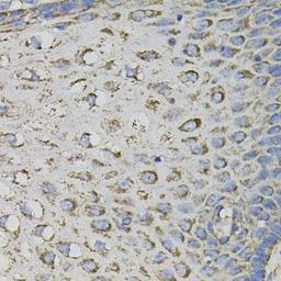 Immunohistochemical staining of mouse lung tissue using PTPRC antibody