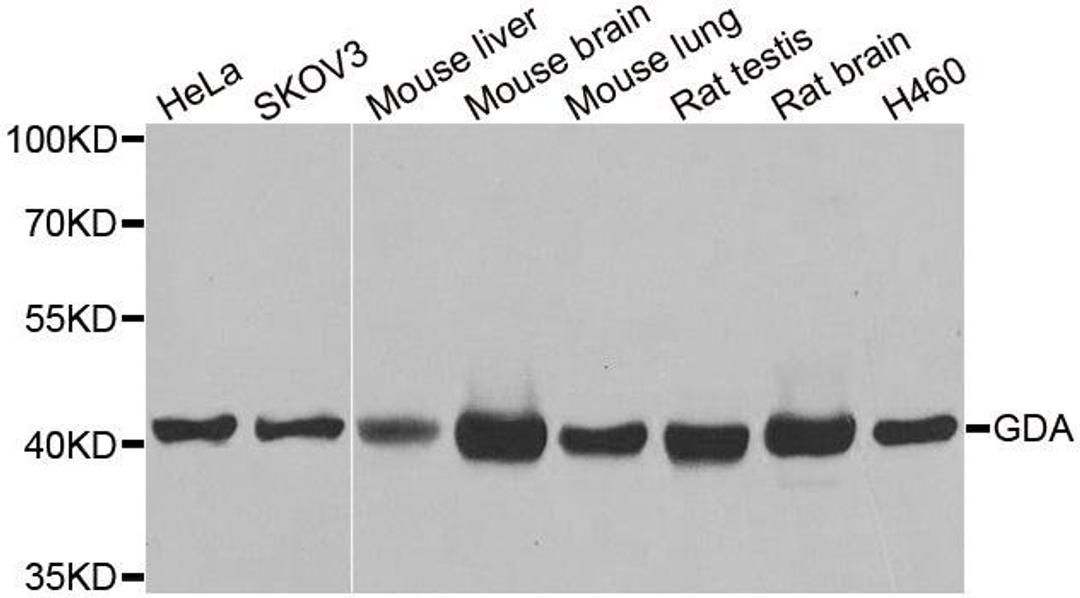 Western blot analysis of extracts of various cell lines using GDA antibody