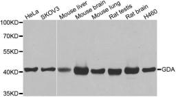 Western blot analysis of extracts of various cell lines using GDA antibody