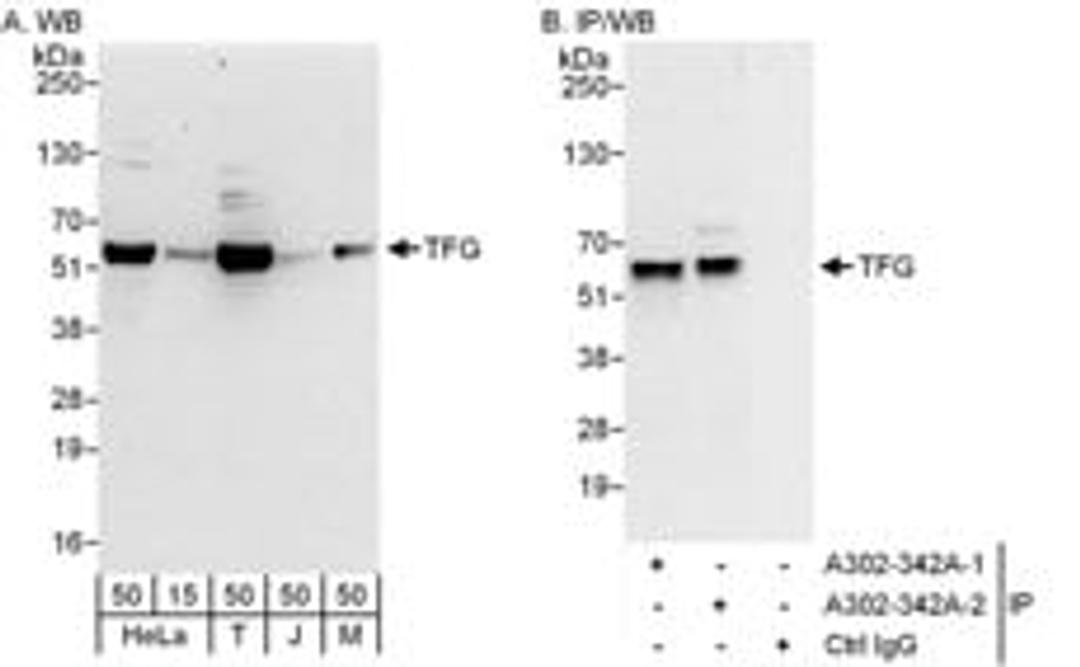 Detection of human and mouse TFG by western blot (h&m) and immunoprecipitation (h).