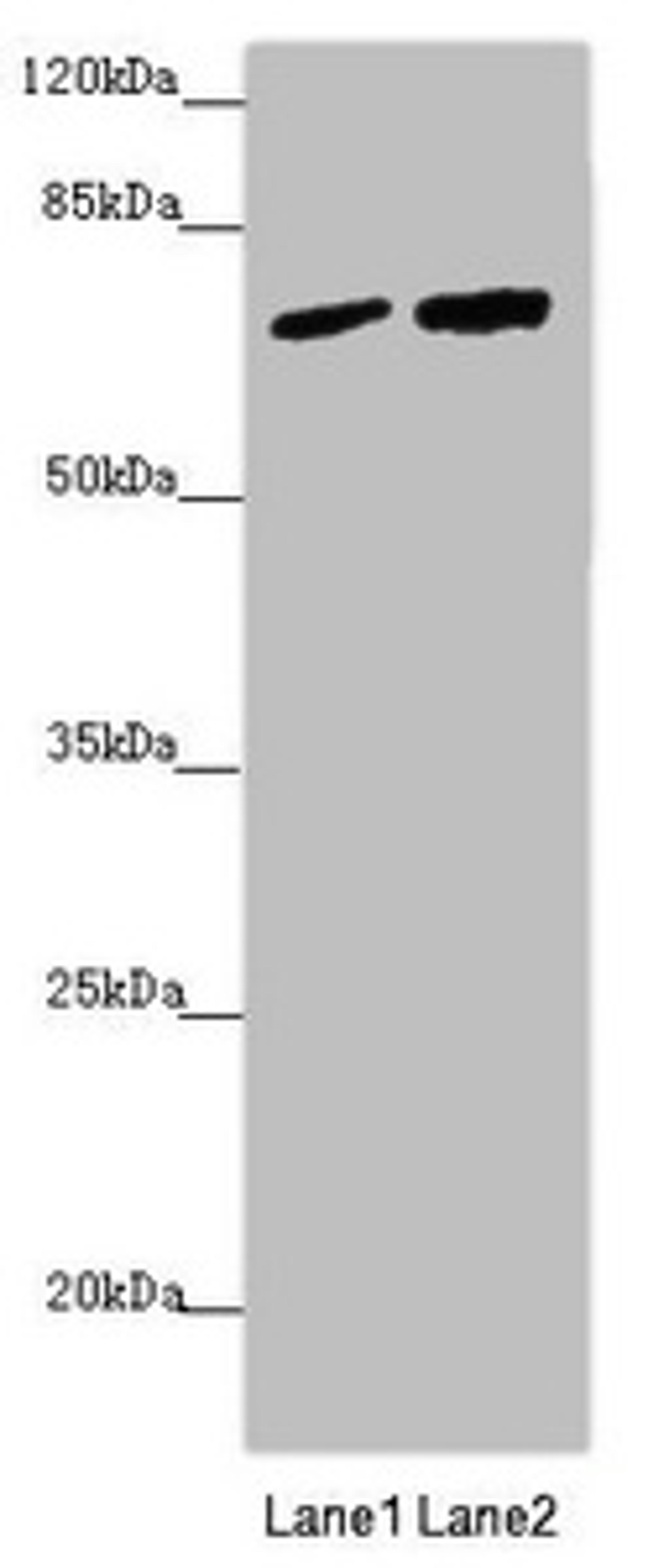 Western blot. All lanes: KIAA0391 antibody at 1.06µg/ml. Lane 1: LO2 whole cell lysate. Lane 2: 293T whole cell lysate. Secondary. Goat polyclonal to rabbit IgG at 1/10000 dilution. Predicted band size: 68, 66, 25, 57 kDa. Observed band size: 68 kDa