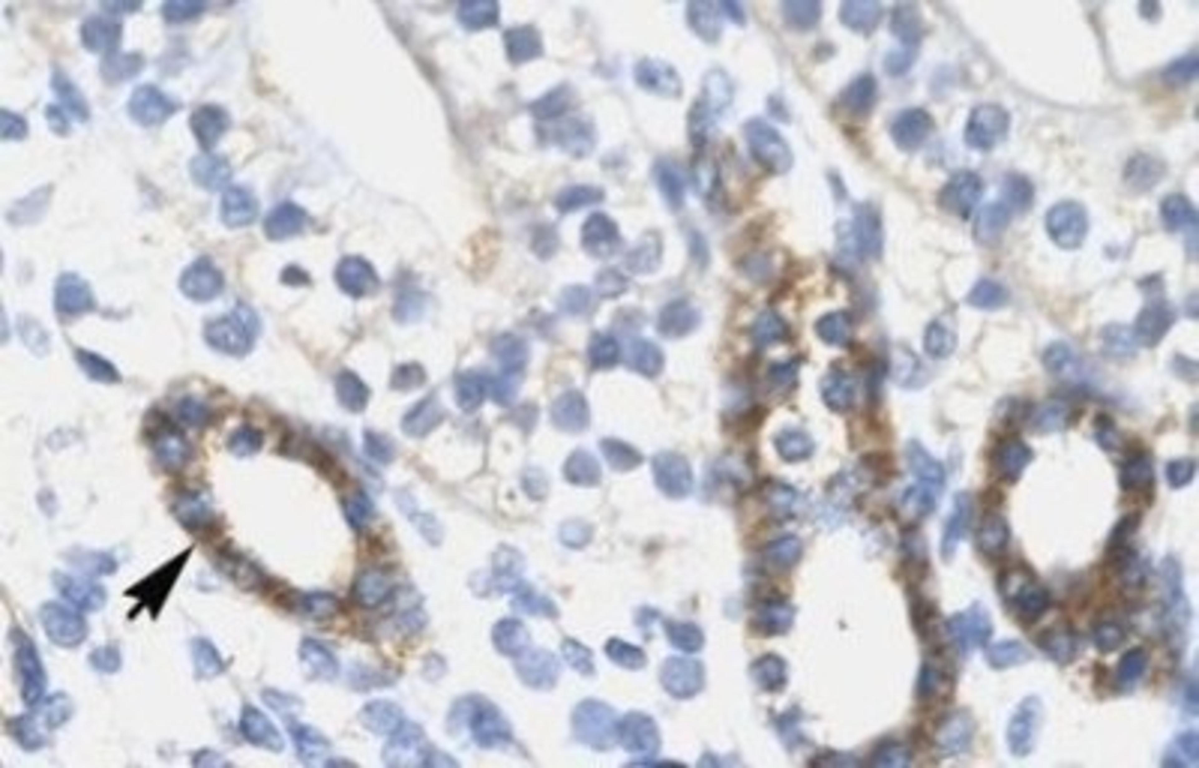 Immunohistochemistry-Paraffin: SOX10 Antibody [NBP1-68983] - Human Kidney Tissue.  Arrow indicates epithelial cells of renal tubule with positive label.