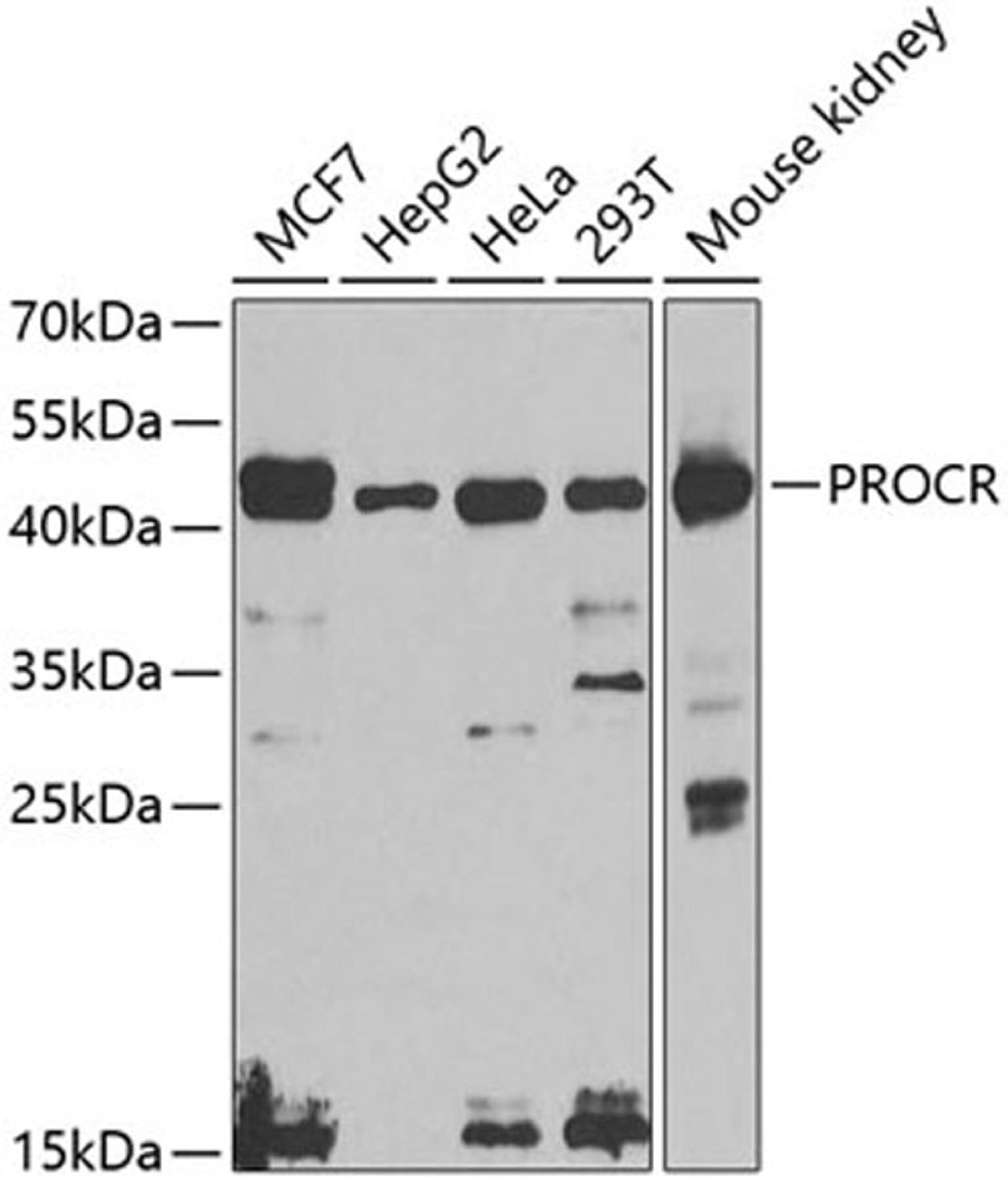 Western blot - PROCR antibody (A5763)