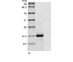 (Tris-Glycine gel) Discontinuous SDS-PAGE (reduced) with 5% enrichment gel and 15% separation gel.