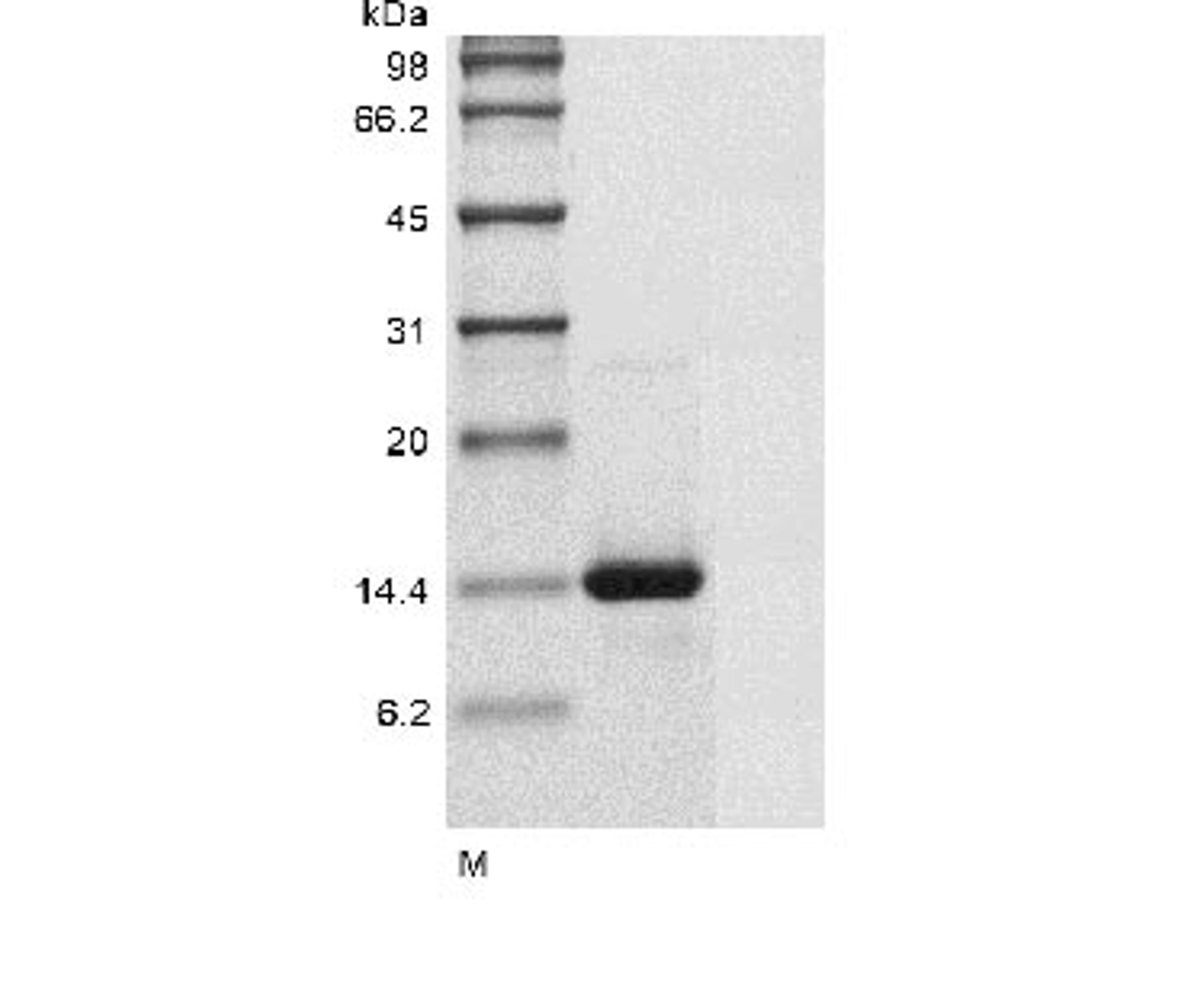 (Tris-Glycine gel) Discontinuous SDS-PAGE (reduced) with 5% enrichment gel and 15% separation gel.