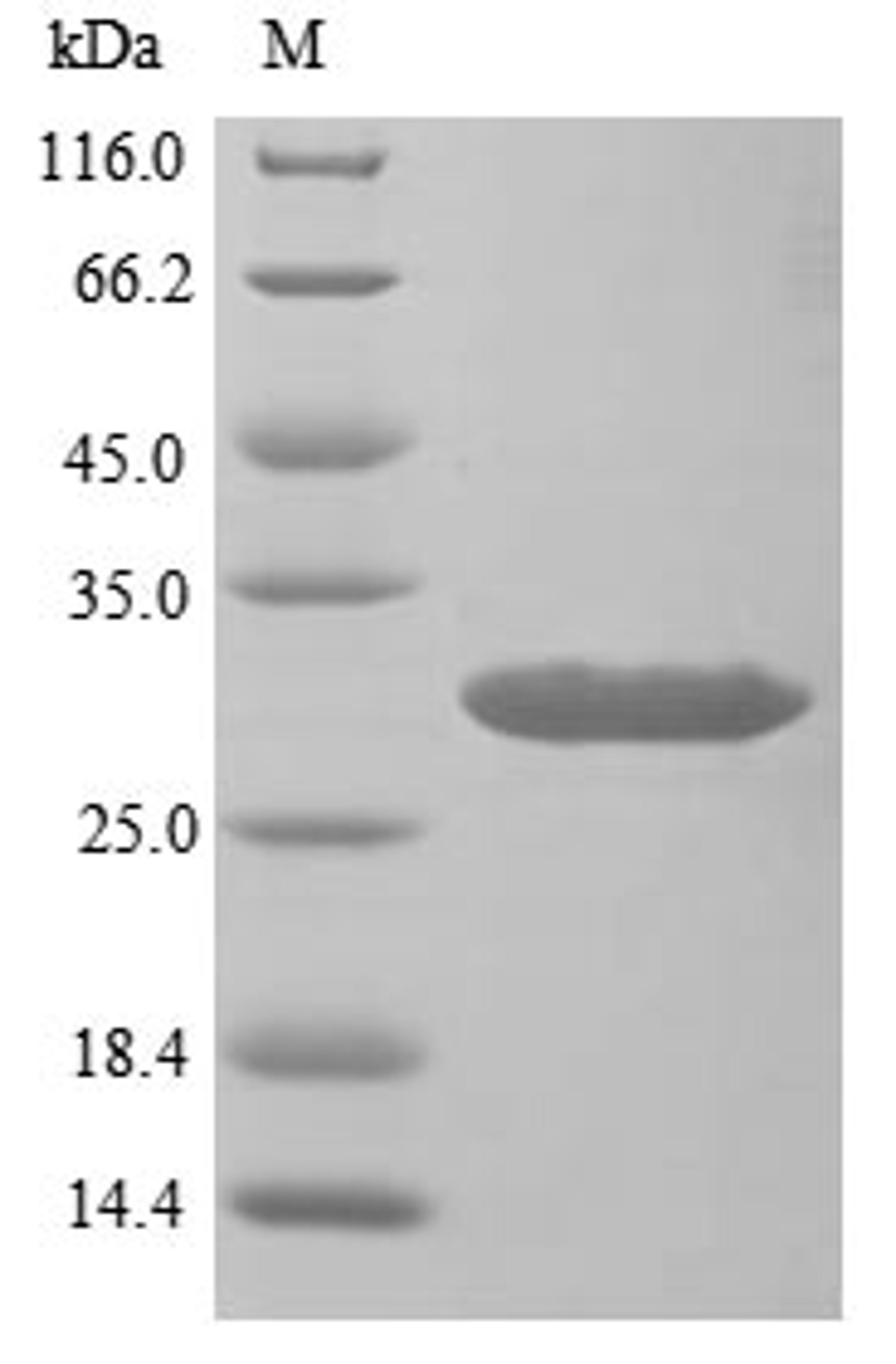 (Tris-Glycine gel) Discontinuous SDS-PAGE (reduced) with 5% enrichment gel and 15% separation gel.