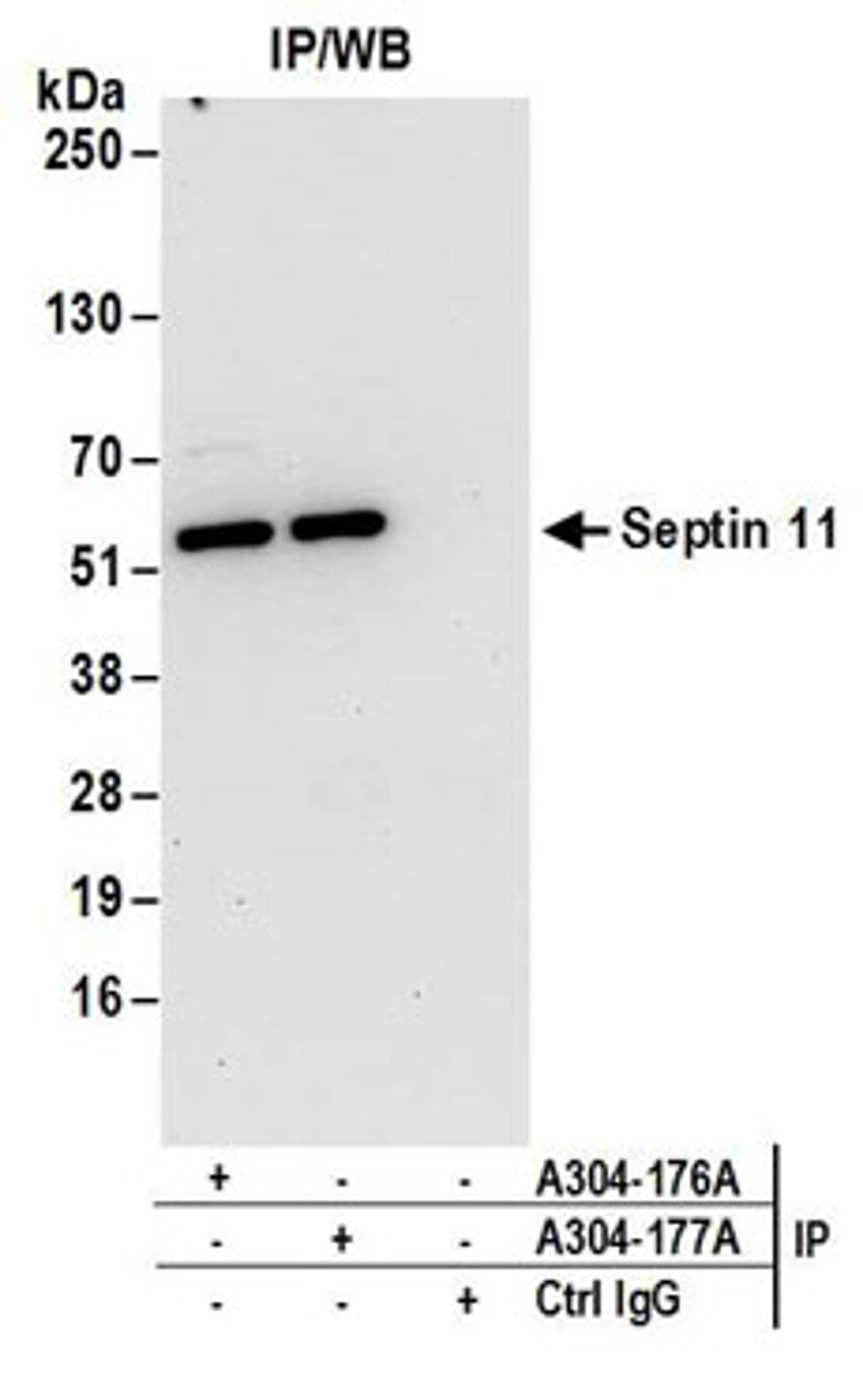 Detection of human Septin 11 by western blot of immunoprecipitates.