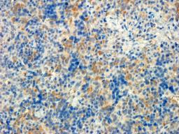 Immunohistochemical staining of rat spleen tissue using CD90 antibody (dilution of primary antibody - 1:100)