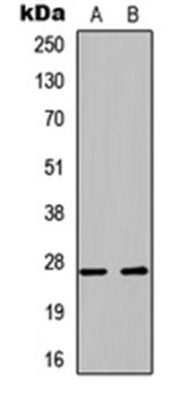 Western blot analysis of A549 (Lane 1), PC12 (Lane 2) whole cell lysates using PLUNC antibody