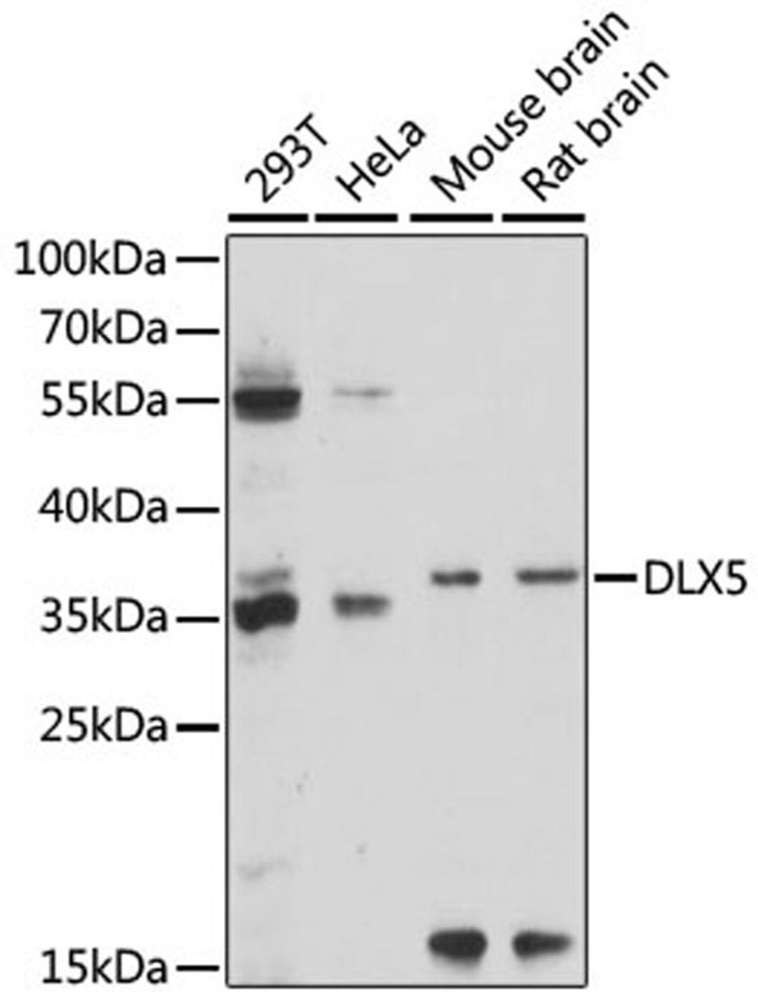 Western blot - DLX5 antibody (A15049)