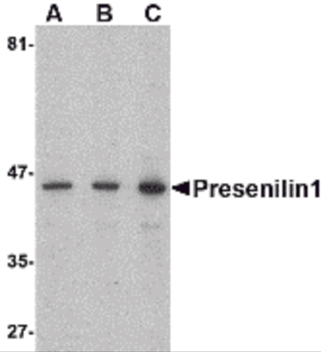 Western blot analysis of presenilin1 in human brain lysate with presenilin1 antibody at (A) 0.5, (B) 1, and (C) 2 &#956;g/mL.