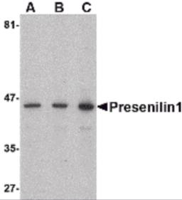 Western blot analysis of presenilin1 in human brain lysate with presenilin1 antibody at (A) 0.5, (B) 1, and (C) 2 &#956;g/mL.