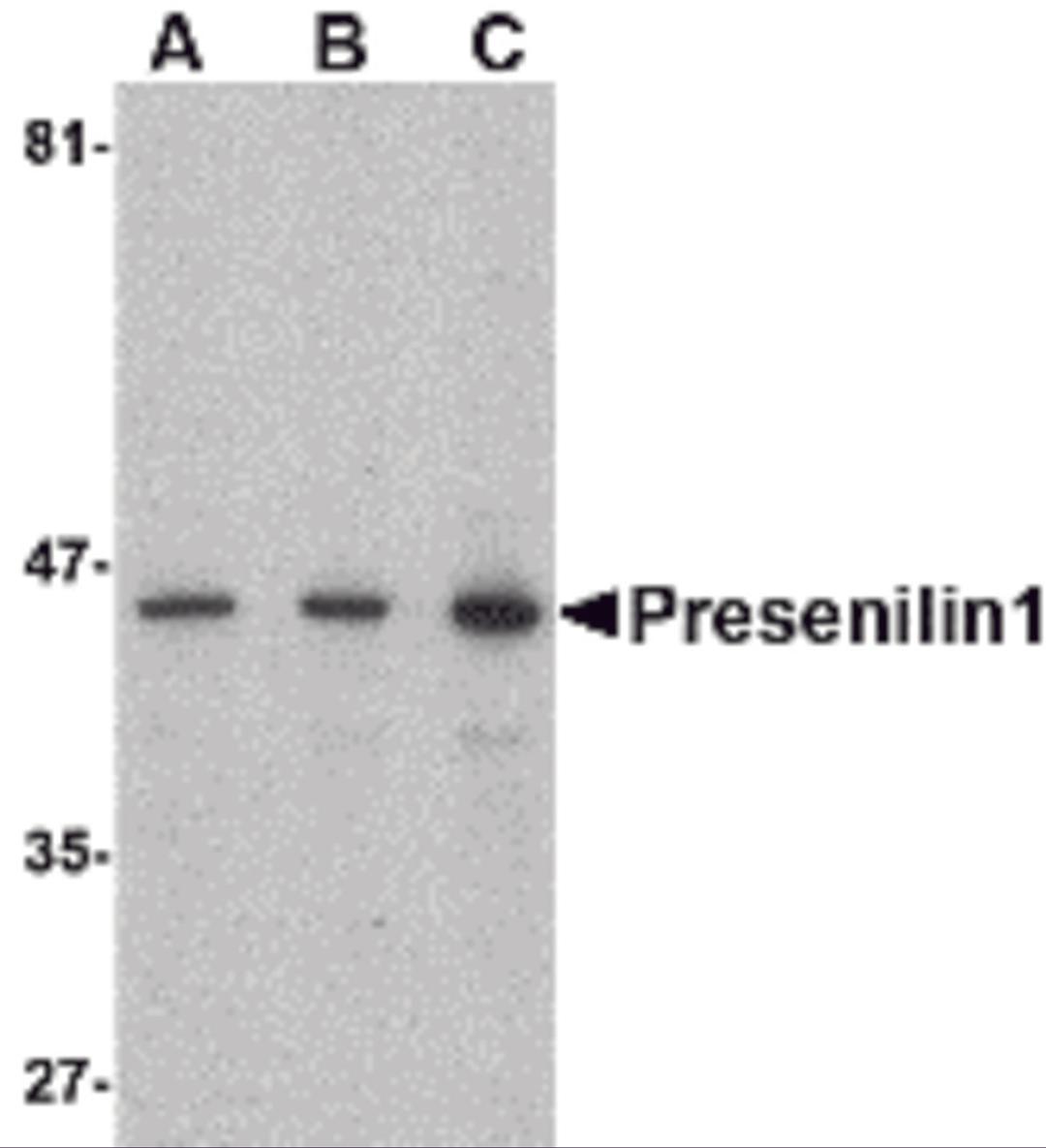 Western blot analysis of presenilin1 in human brain lysate with presenilin1 antibody at (A) 0.5, (B) 1, and (C) 2 μg/mL.