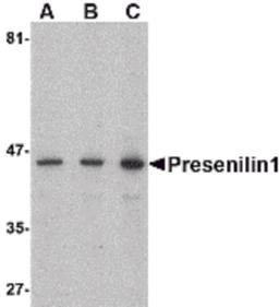 Western blot analysis of presenilin1 in human brain lysate with presenilin1 antibody at (A) 0.5, (B) 1, and (C) 2 μg/mL.