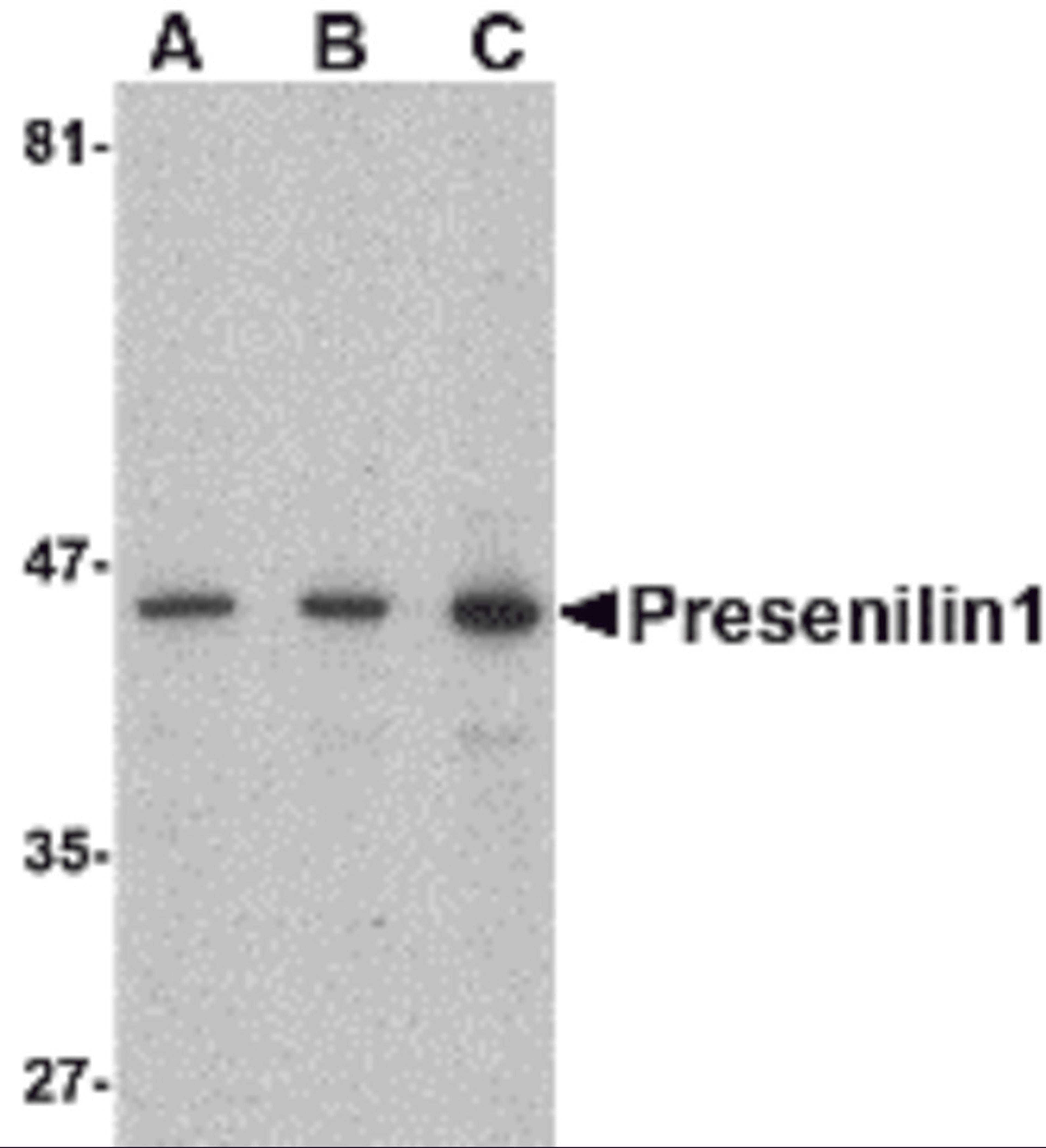 Western blot analysis of presenilin1 in human brain lysate with presenilin1 antibody at (A) 0.5, (B) 1, and (C) 2 μg/mL.