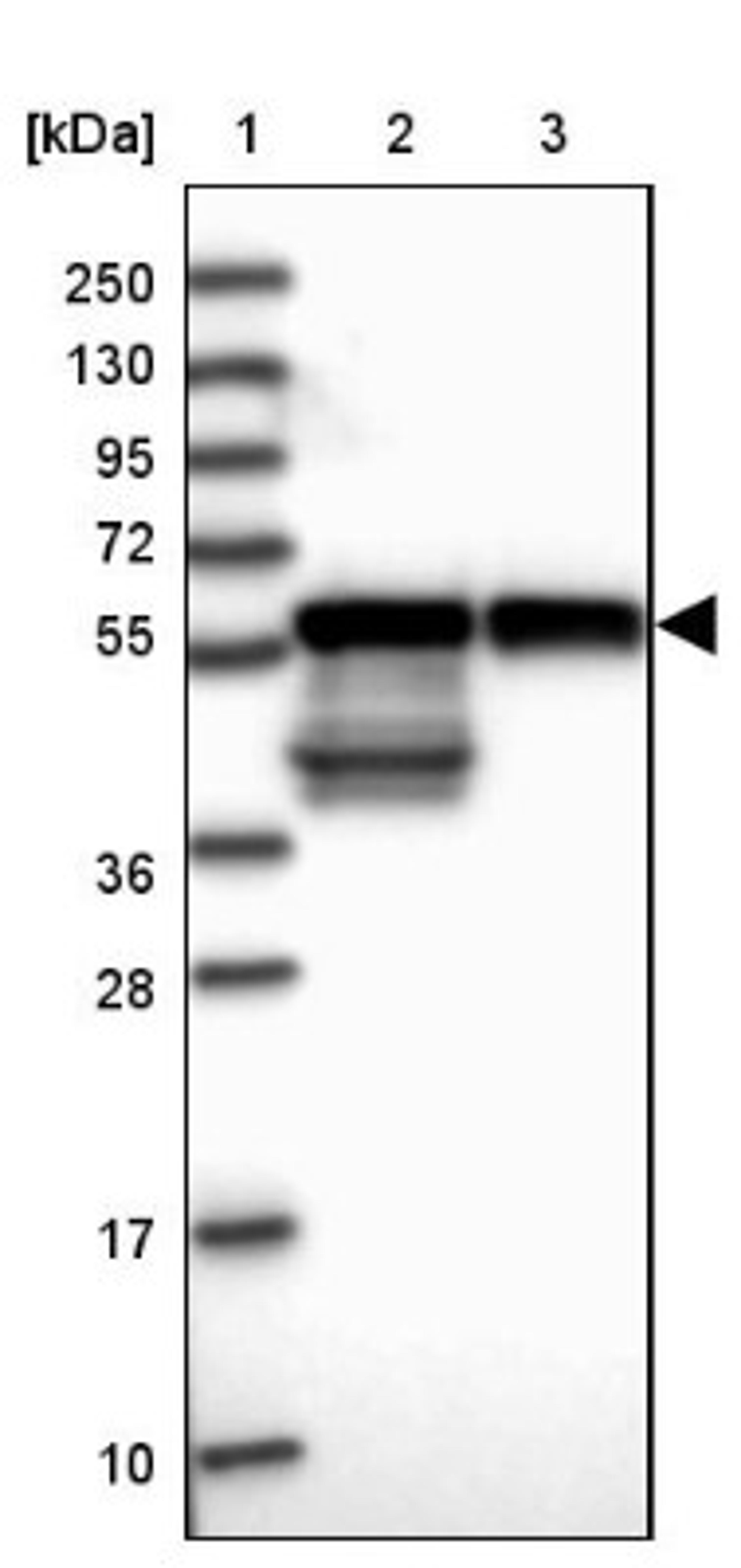 Western Blot: CARS2 Antibody [NBP2-32597] - Lane 1: Marker [kDa] 250, 130, 95, 72, 55, 36, 28, 17, 10<br/>Lane 2: Human cell line RT-4<br/>Lane 3: Human cell line U-251MG sp