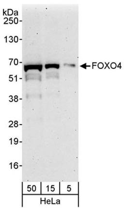 Detection of human FOXO4 by western blot.