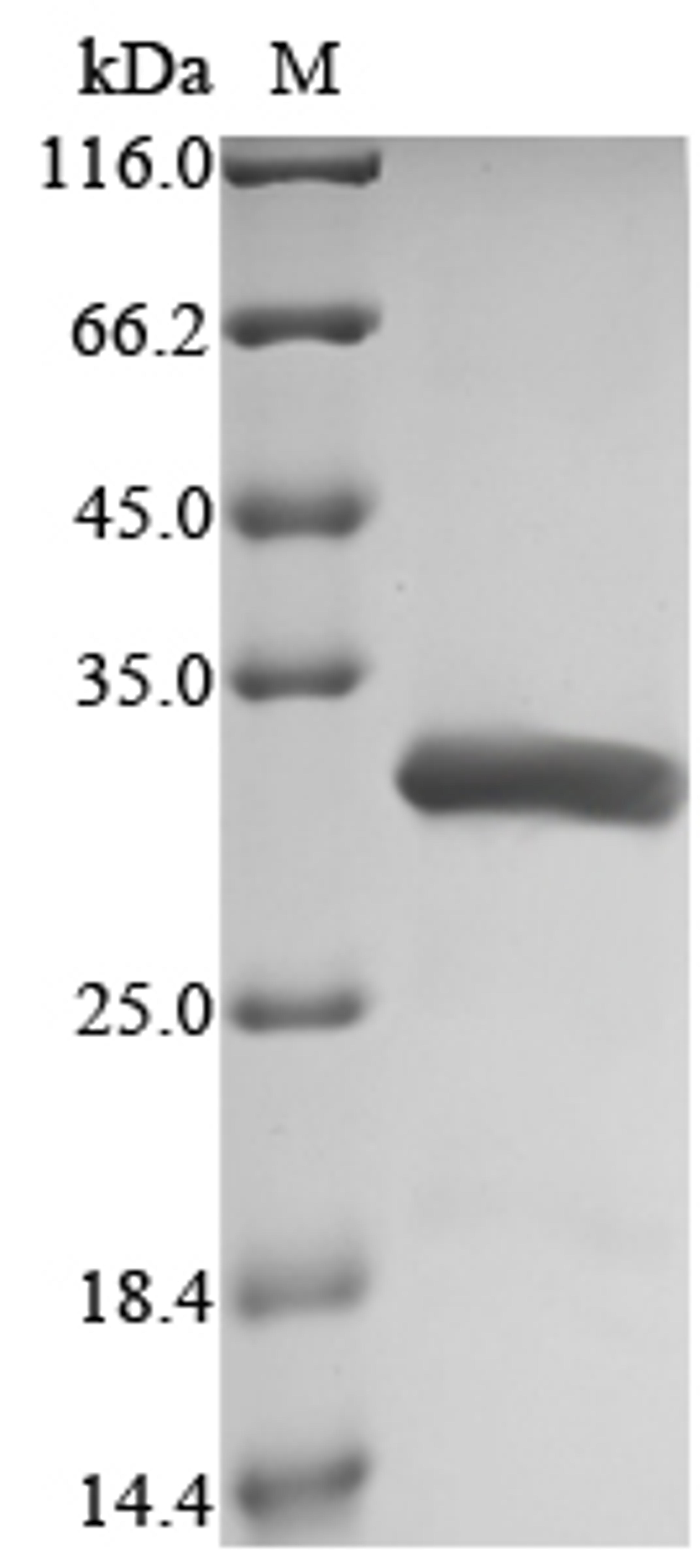 (Tris-Glycine gel) Discontinuous SDS-PAGE (reduced) with 5% enrichment gel and 15% separation gel.