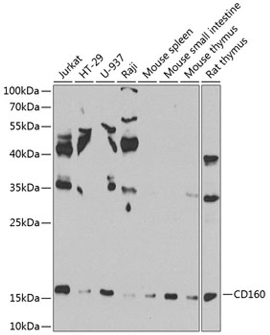 Western blot - CD160 antibody (A8189)