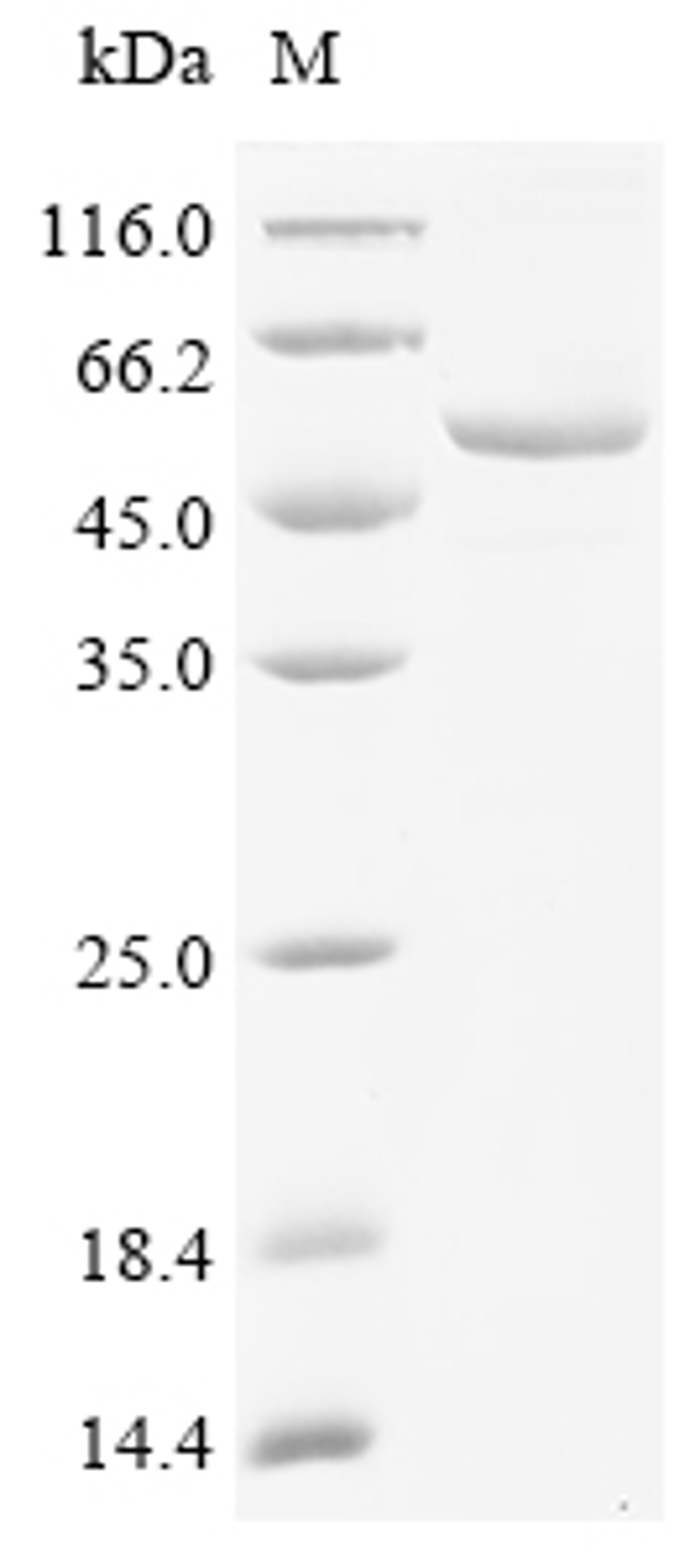 (Tris-Glycine gel) Discontinuous SDS-PAGE (reduced) with 5% enrichment gel and 15% separation gel.
