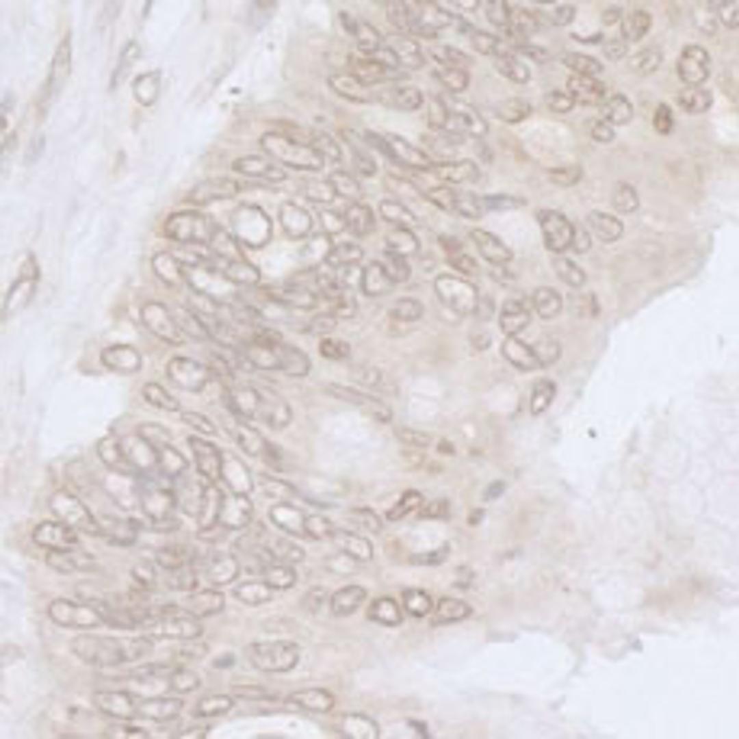 Detection of human NUP35 by immunohistochemistry.